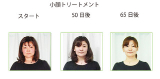 顔比較写真のコピー.jpg